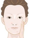 Exfoliación de la piel de la cara y el cuerpo