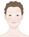 Hiperpigmentación - Cómo corregir el tono desigual de la piel