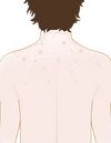 la piel impura de la espalda