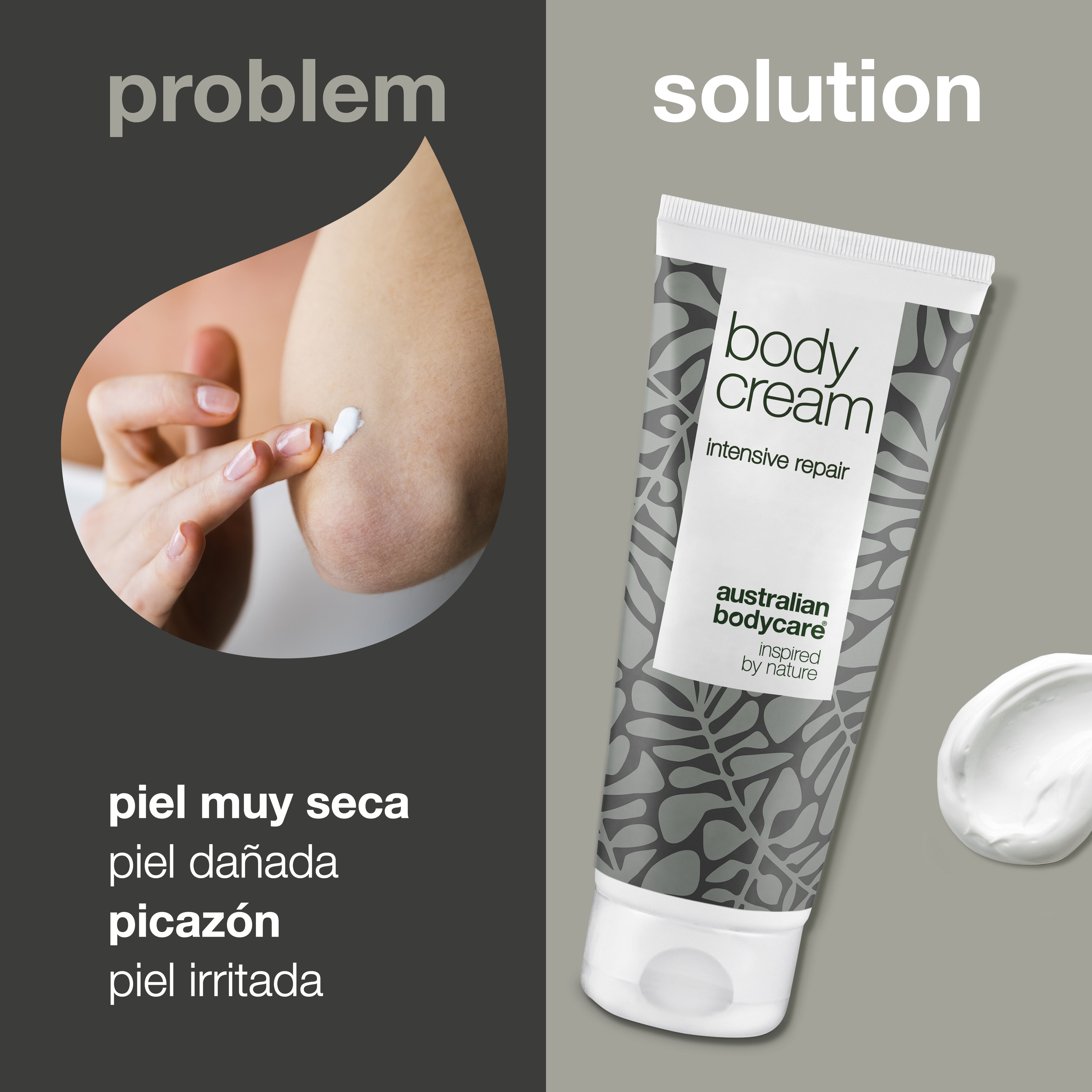 Crema Corporal para pieles muy secas y con picores — Hidratante corporal intensiva para pieles dañadas, muy secas y con picores