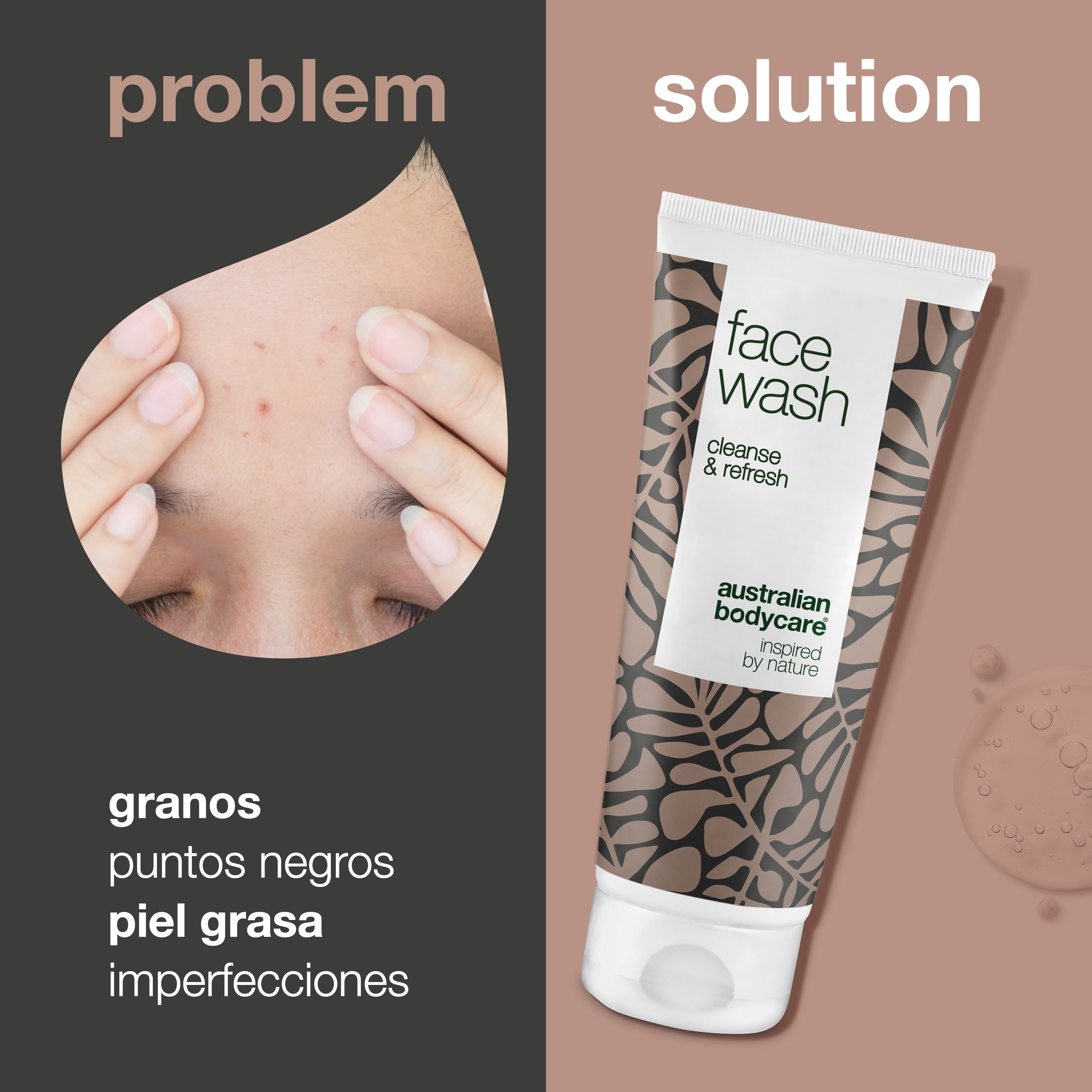Jabón facial de árbol de té para espinillas y puntos negros: limpiador facial diario para pieles grasas, ideal para pieles con imperfecciones y acné.