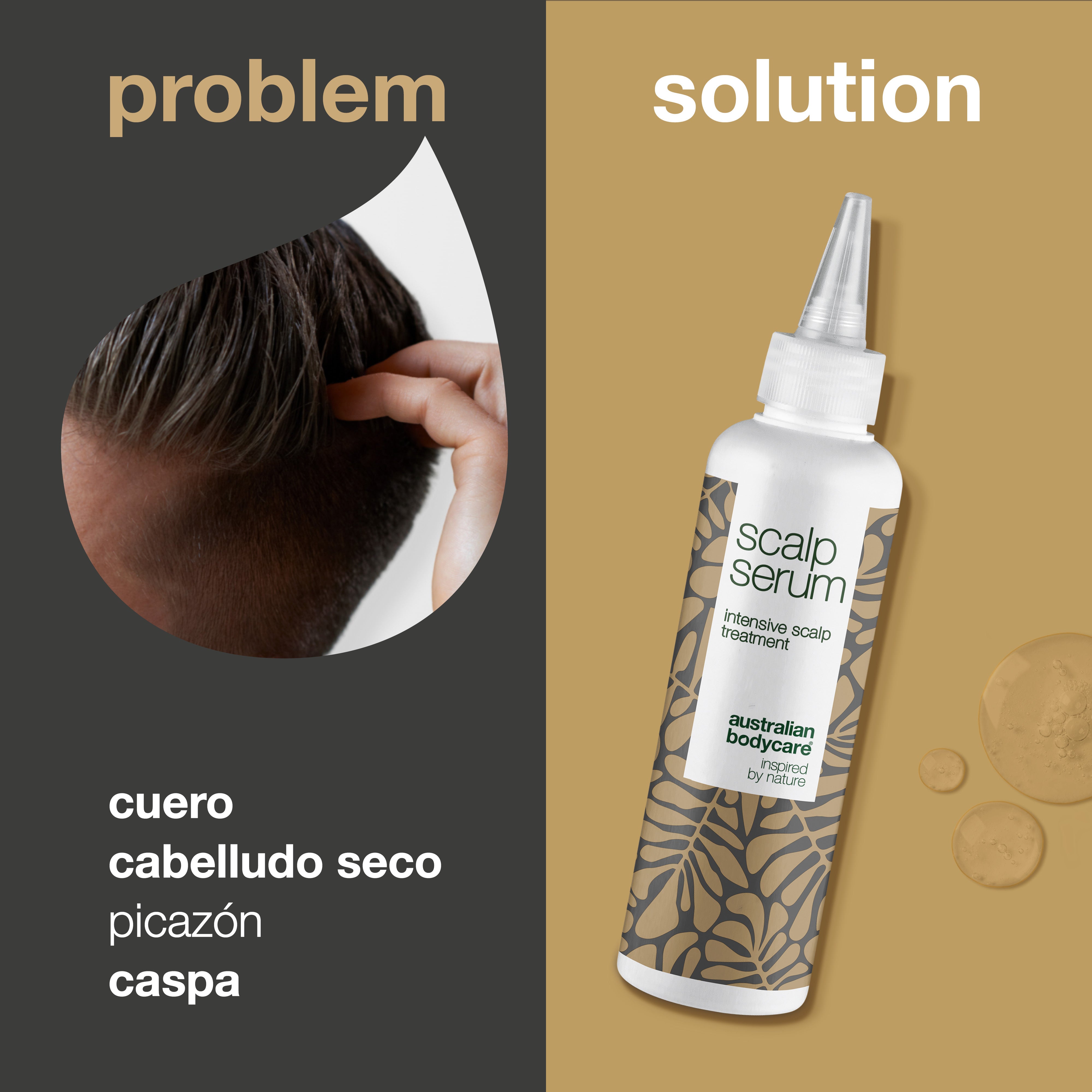 Tratamiento del cuero cabelludo contra la caspa y el cuero cabelludo seco: suero para el cuero cabelludo con picazón, cabello graso, piel seca e irritación del cuero cabelludo.