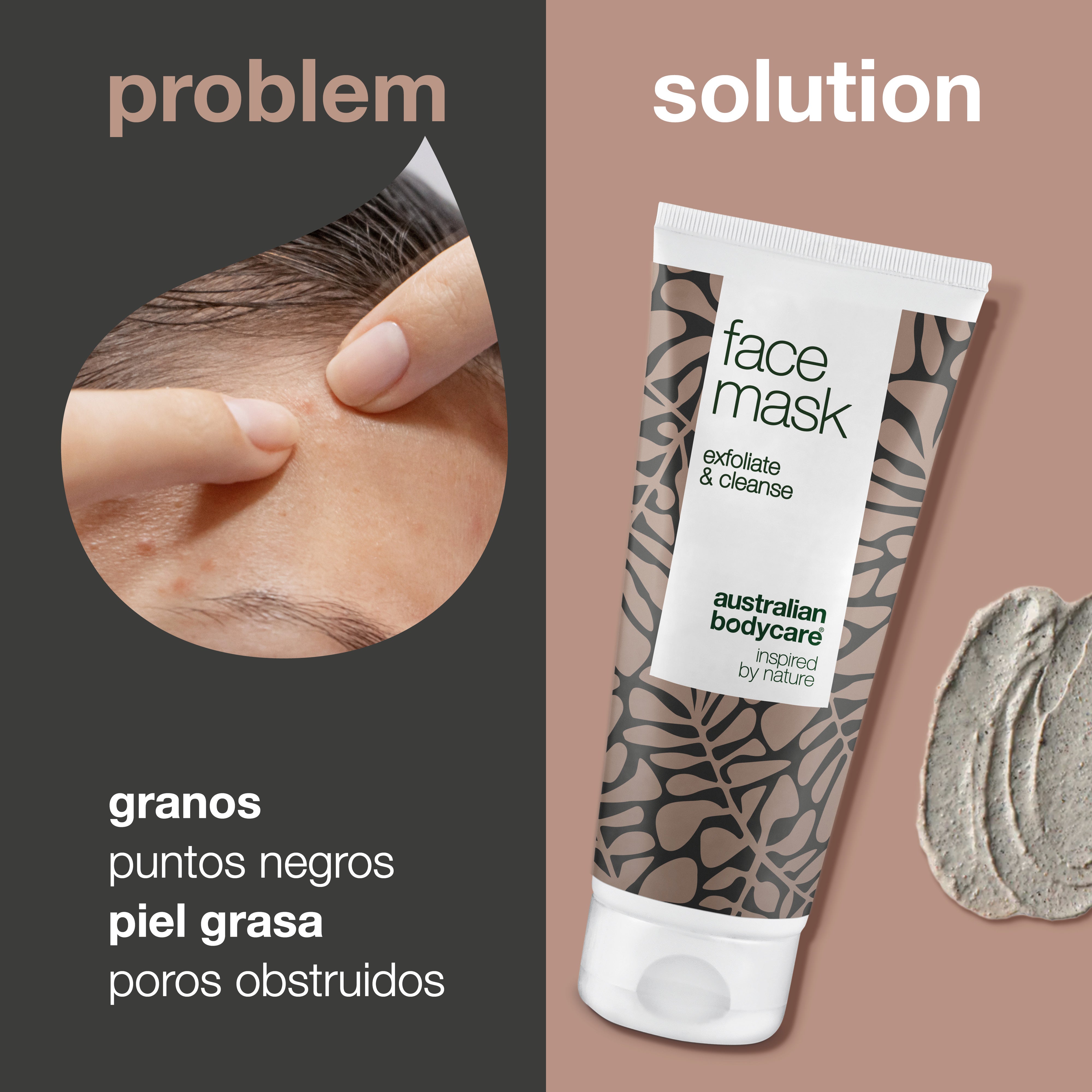Mascarilla limpiadora para pieles congestionadas y grasas — Mascarilla de arcilla de limpieza profunda para hombres y mujeres, para eliminar puntos negros y espinillas