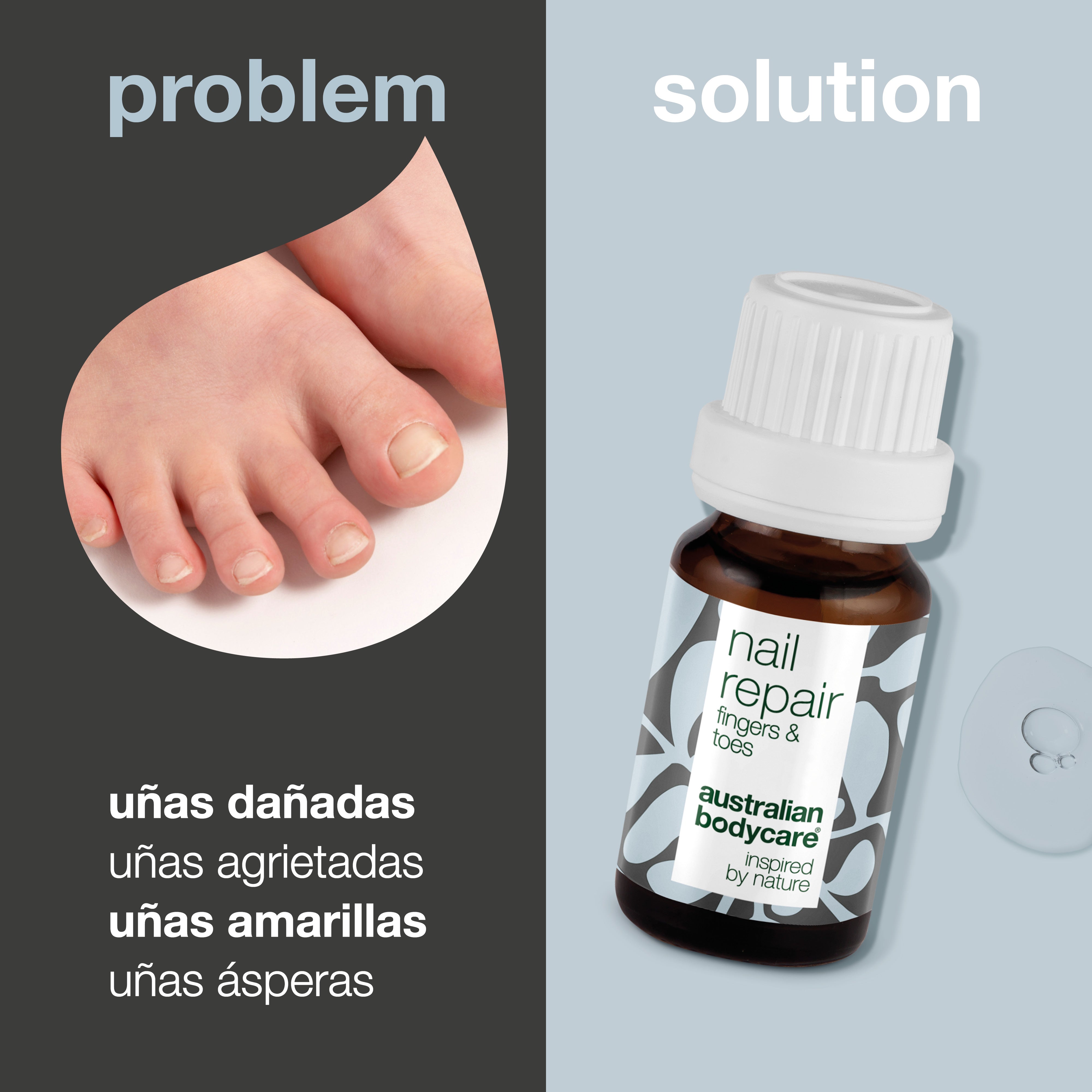 Aceite de uñas para uñas agrietadas y descoloridas: restaure la salud de sus uñas con nuestro aceite de uñas. Combate las uñas agrietadas, ásperas y descoloridas utilizando 4-terpineol natural, conocido por el aceite del árbol del té, y vitamina E.