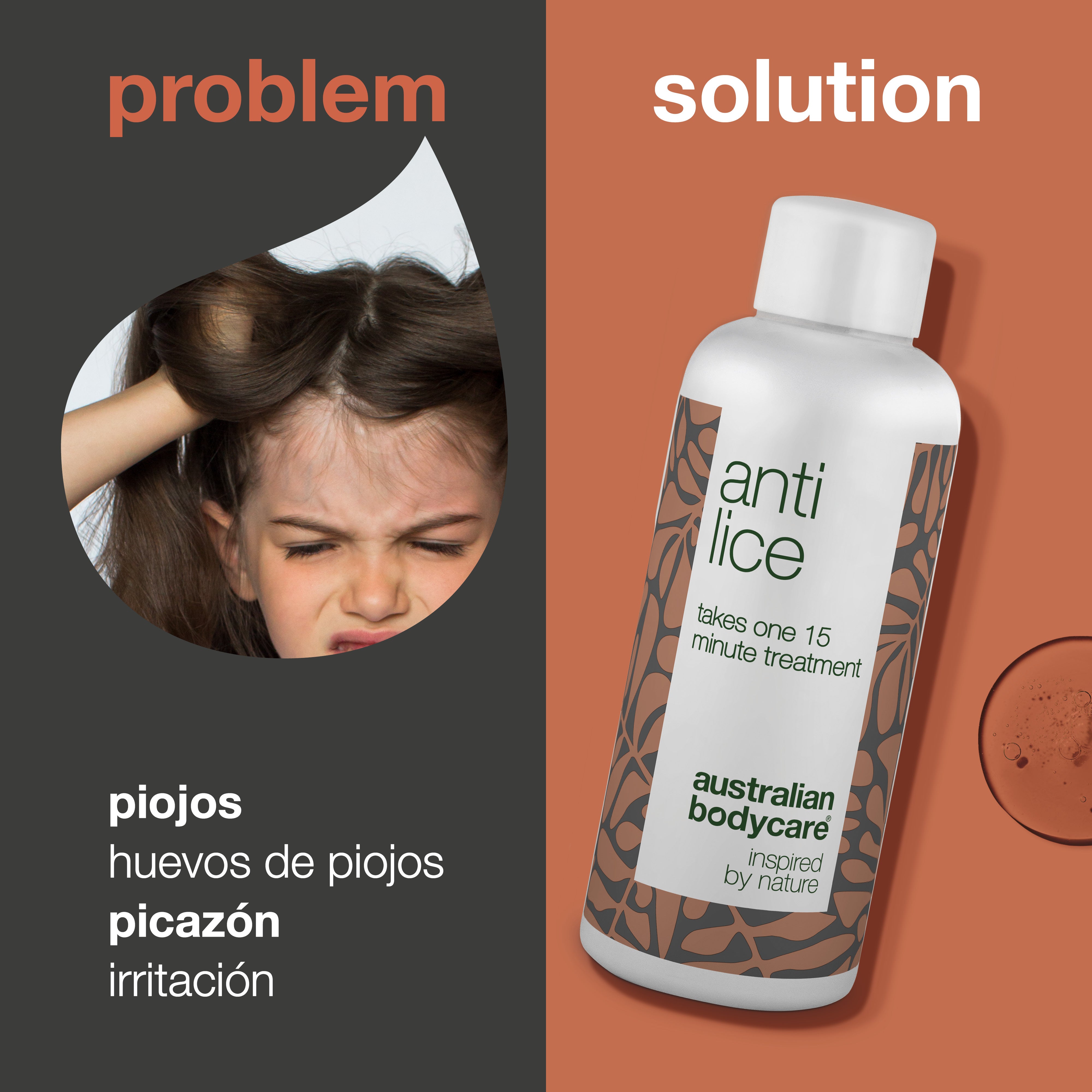 Tratamiento contra piojos: cura eficaz para piojos y huevos en 15 minutos: tratamiento contra piojos no tóxico con ingredientes naturales. Encapsula y asfixia piojos y huevos. Sin parabenos ni insecticidas.