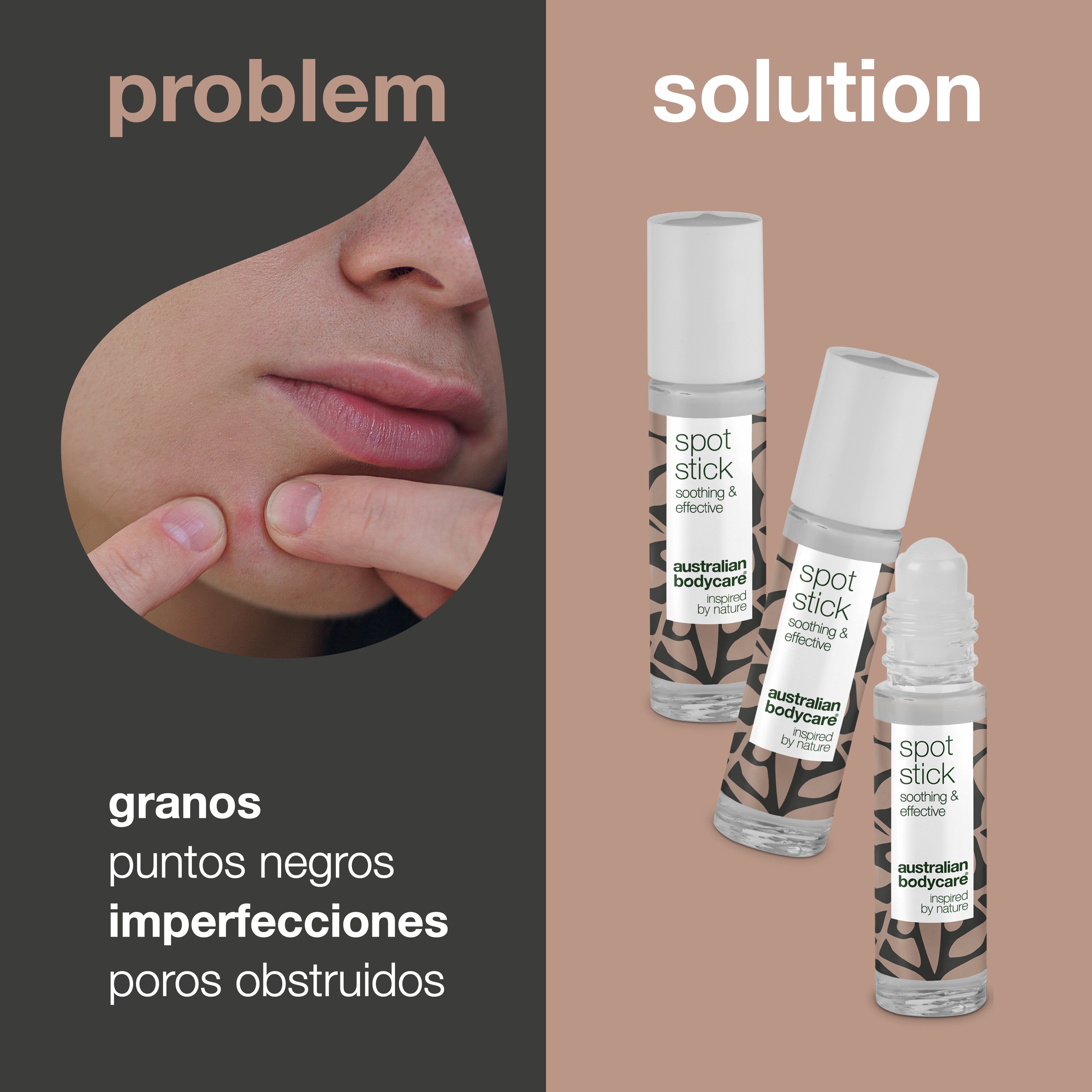 3 barras antimanchas de aceite de árbol de té para espinillas y puntos negros: eficaz contra espinillas, impurezas y puntos negros.