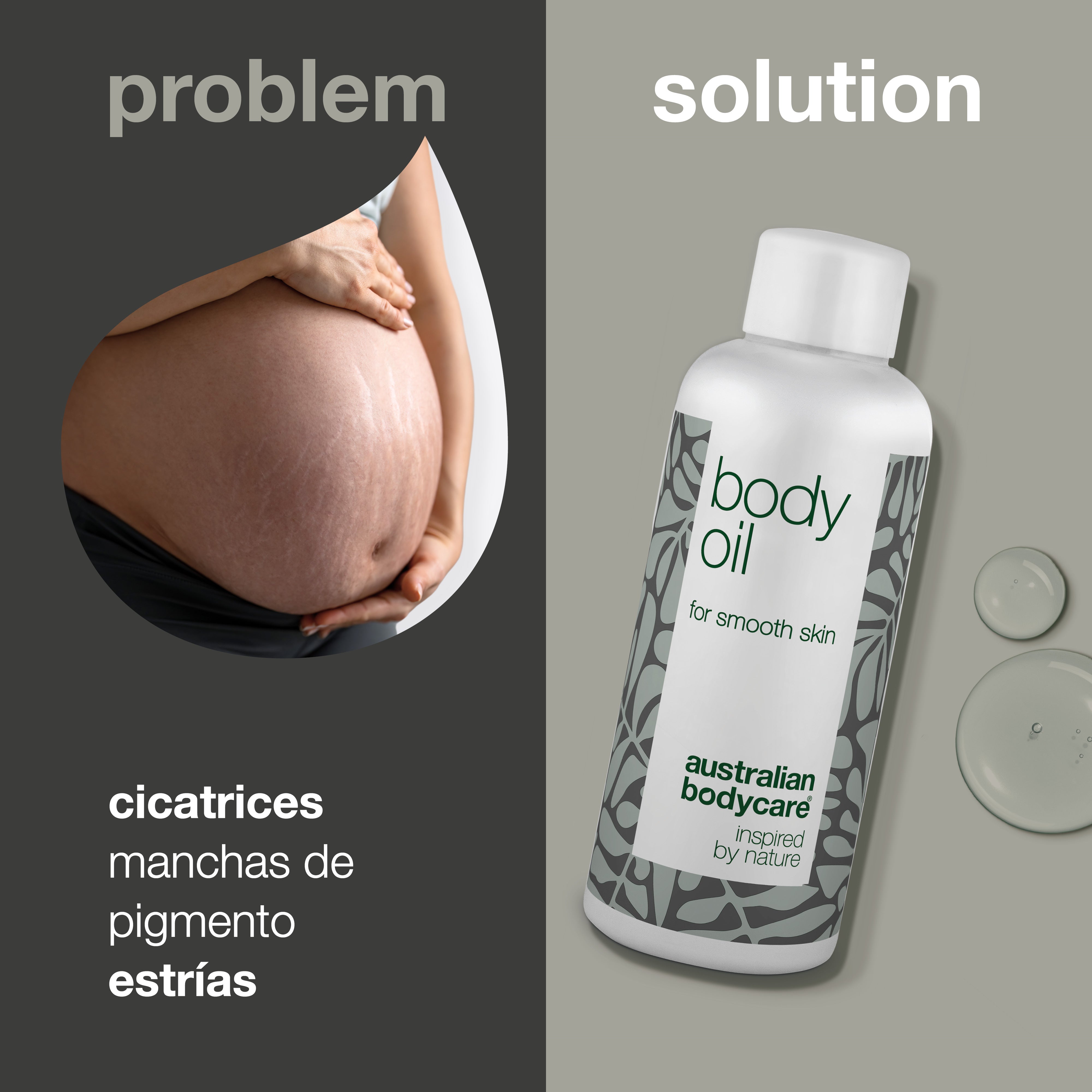 Aceite Corporal para estrías, celulitis y cicatrices — Reduce la apariencia de estrías, hiperpigmentación, cicatrices y piel de naranja