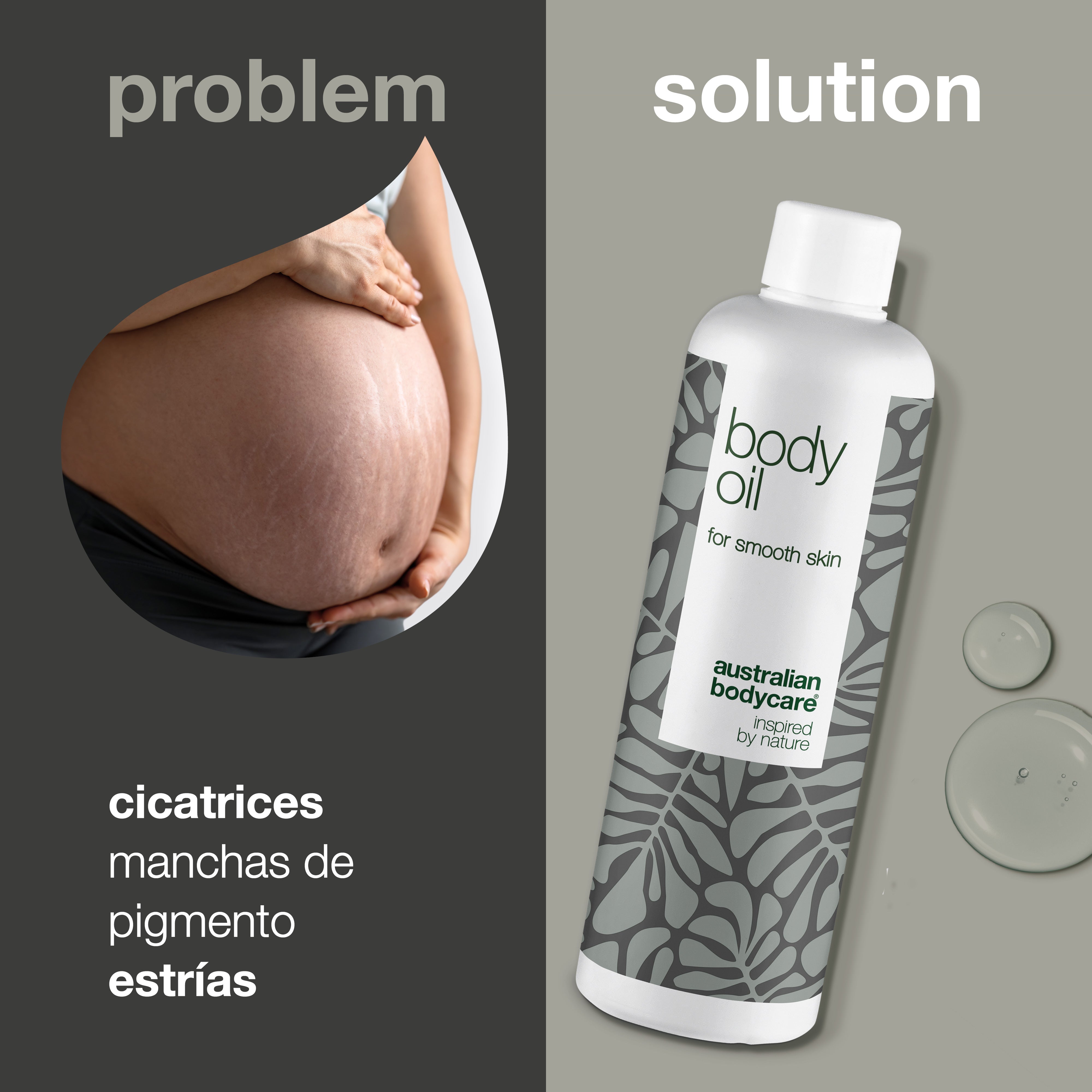 Body Oil – Reduce estrías, cicatrices y manchas oscuras — Body Oil reduce estrías, cicatrices y manchas. Con aceite de almendras, escualano y vitamina E, hidrata y suaviza la piel.