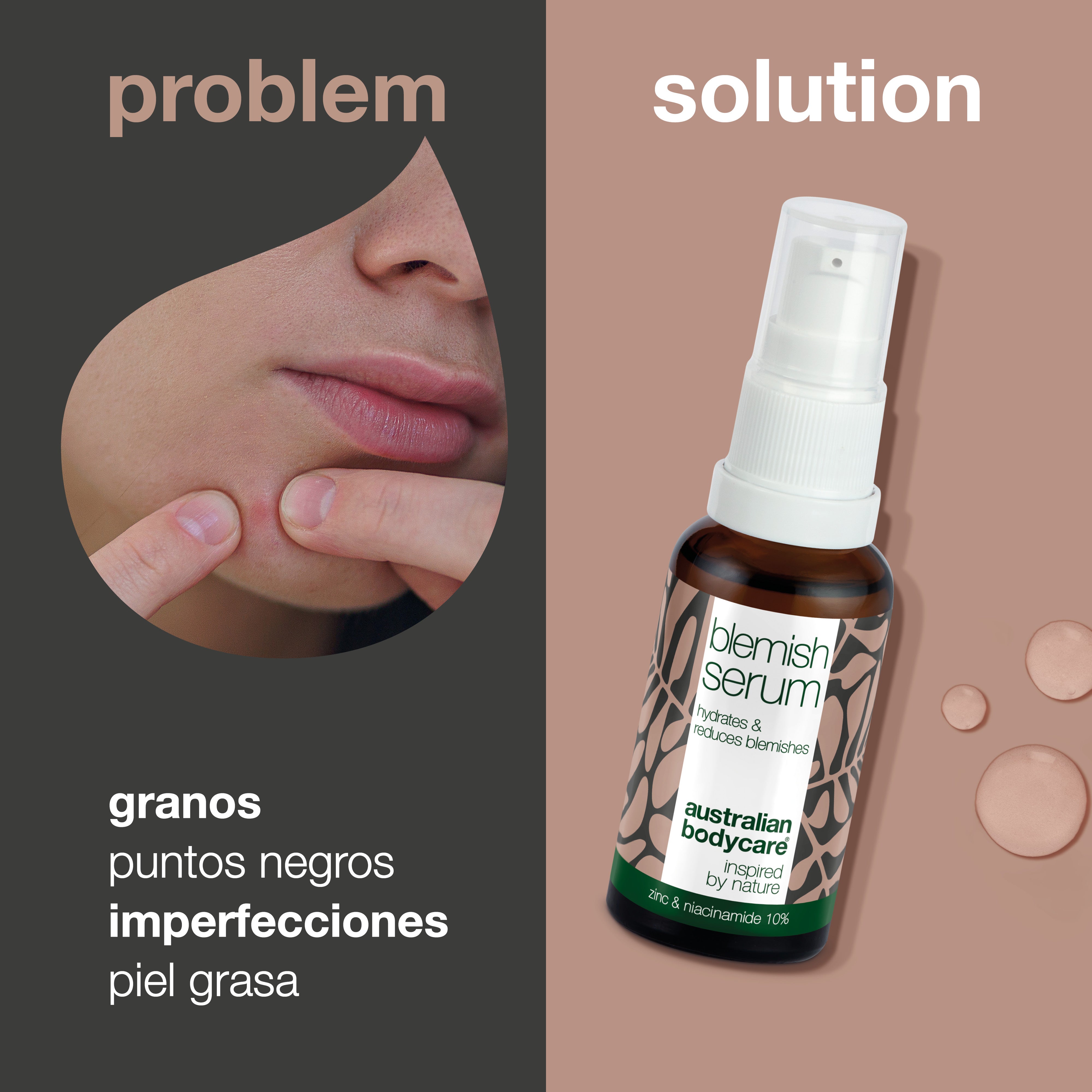 Suero de niacinamida para manchas y piel congestionada: con niacinamida al 10 %, zinc al 1 % y aceite de árbol de té para espinillas, puntos negros y imperfecciones de la piel.
