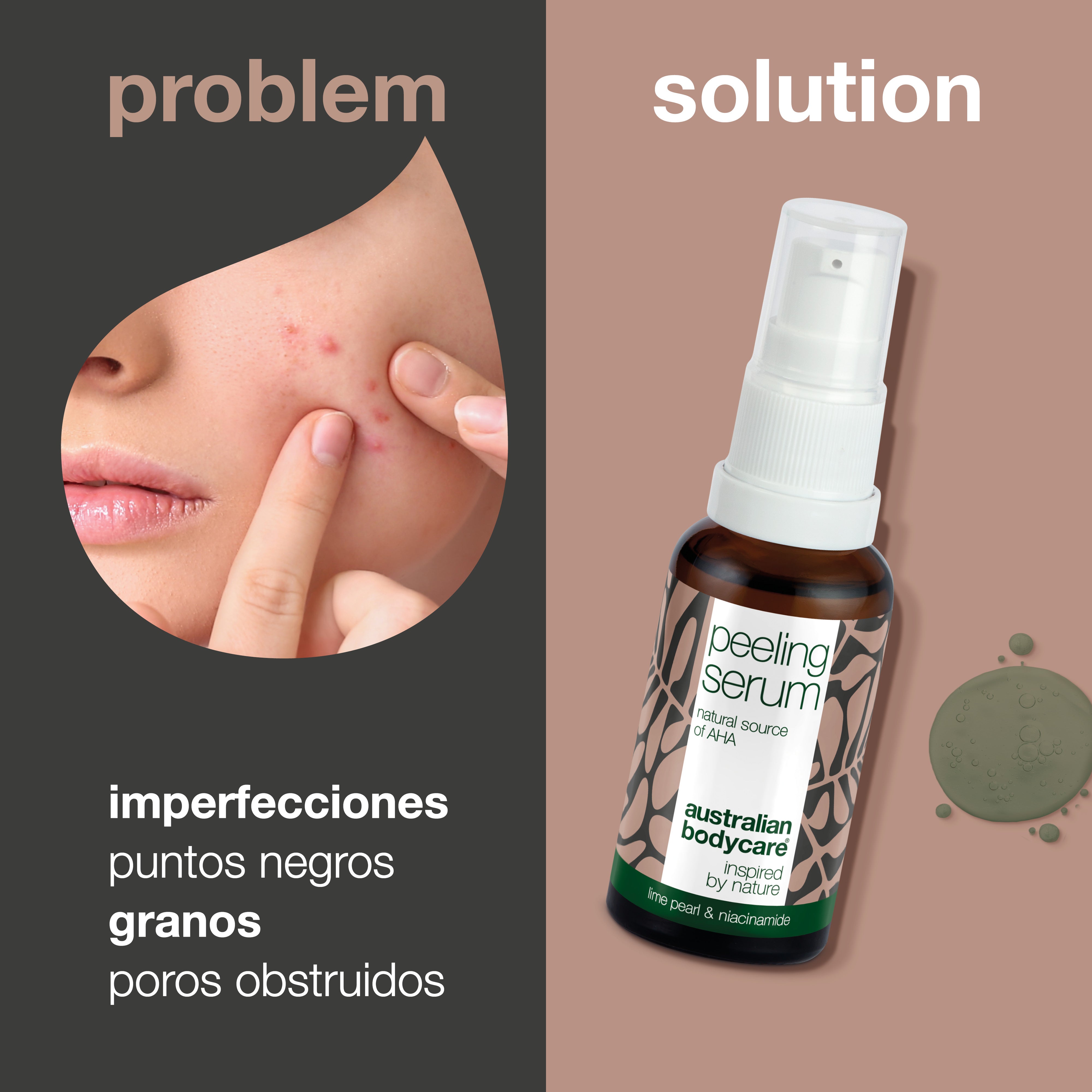 Suero exfoliante con AHA para una exfoliación suave de la piel: suero exfoliante natural con ácido frutal AHA, aceite de árbol de té y niacinamida