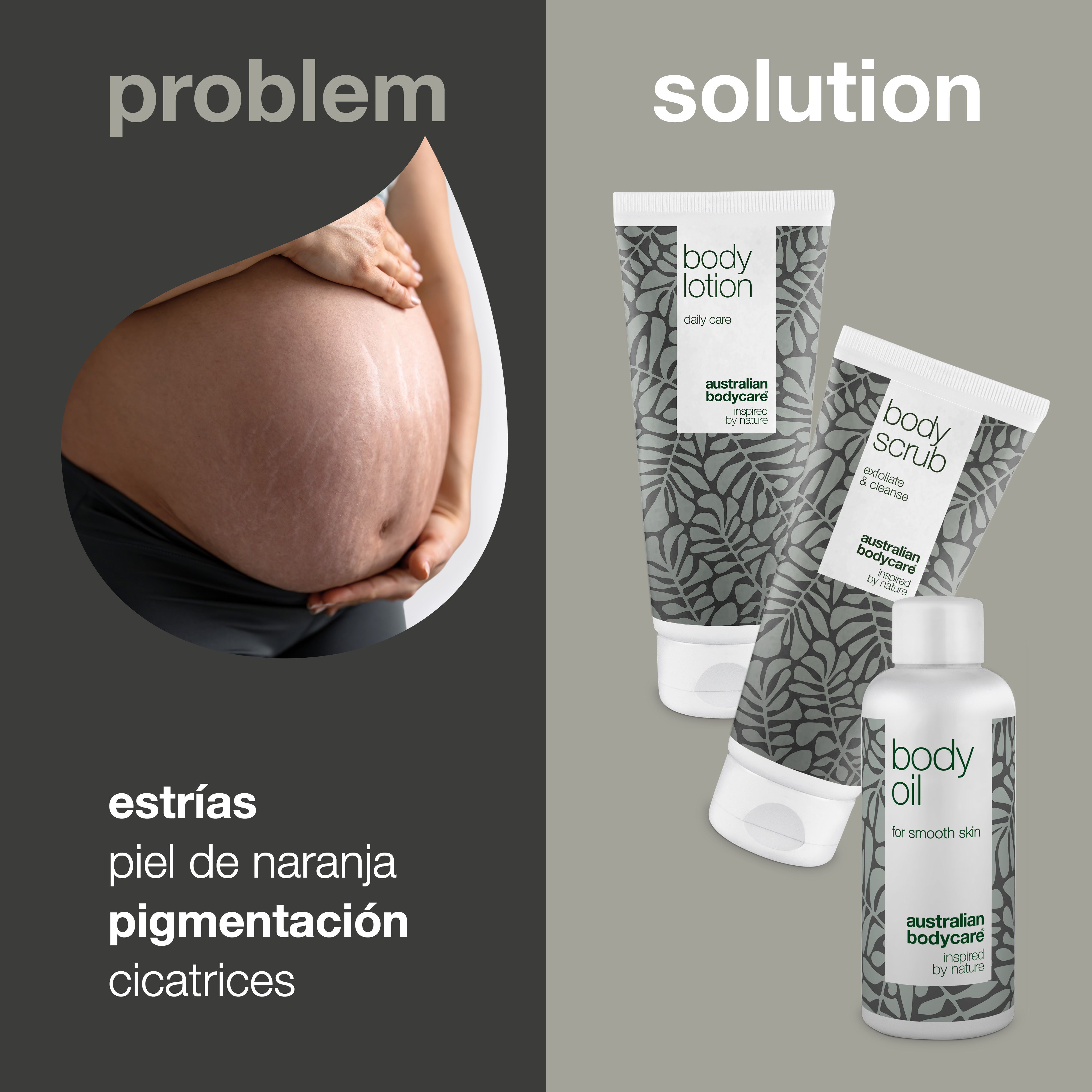 3–Pack para reducir las estrías — 3 productos para reducir la visibilidad de estrías y cicatrices