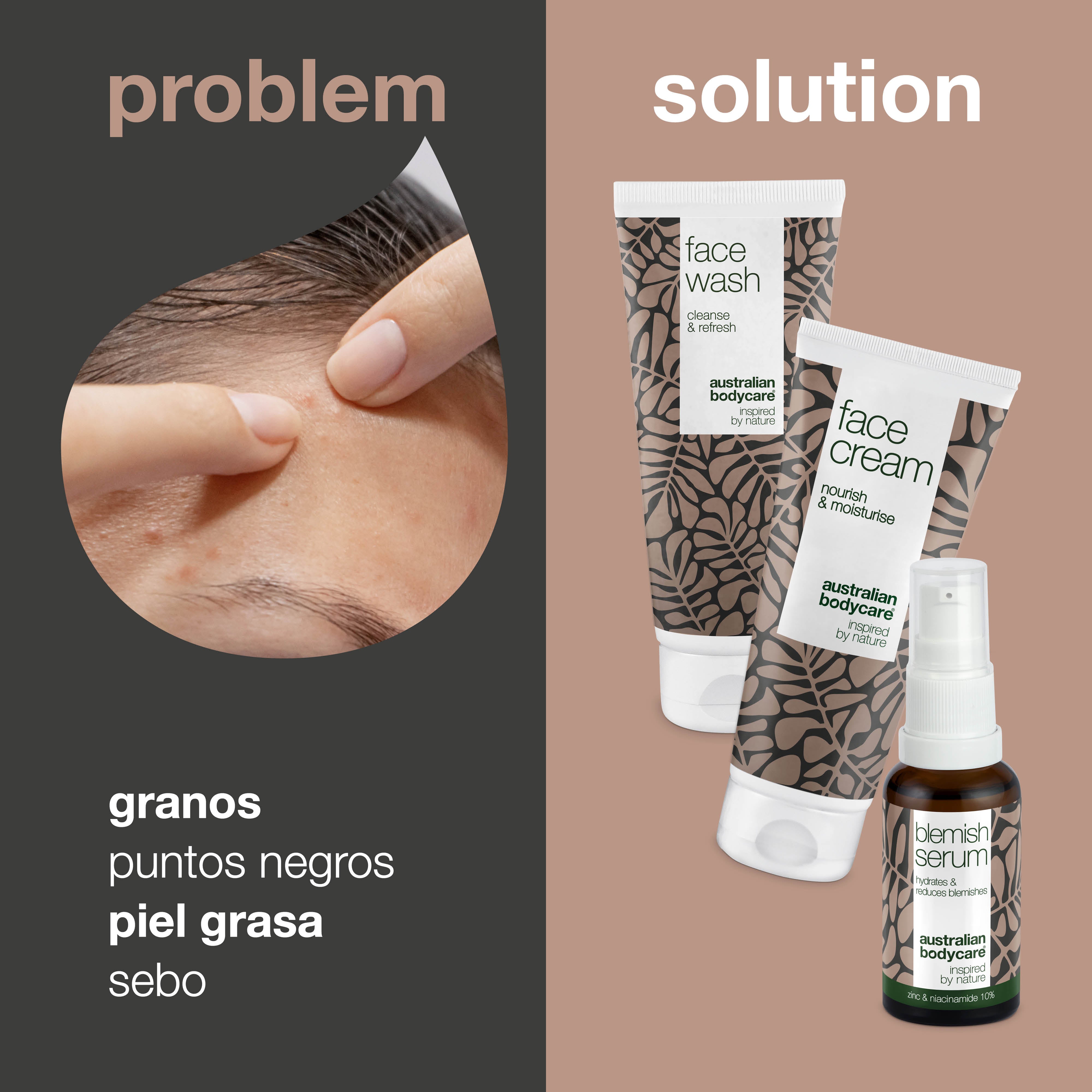 Kit para pieles con acné y grasas: 3 productos para el cuidado diario de pieles con acné y grasas