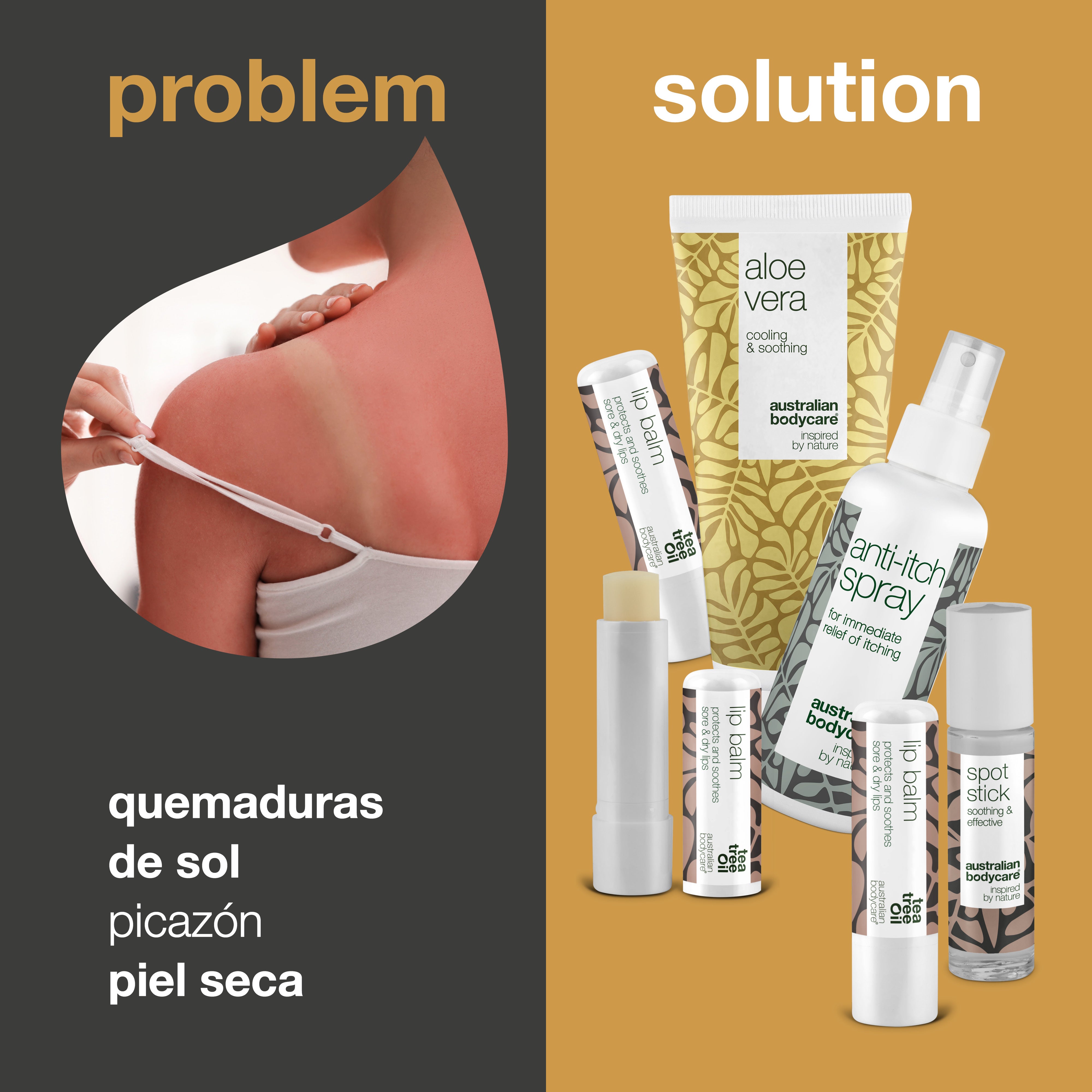 Productos para el cuidado de la piel durante las vacaciones de verano: productos para tratar las quemaduras solares y otros problemas de la piel
