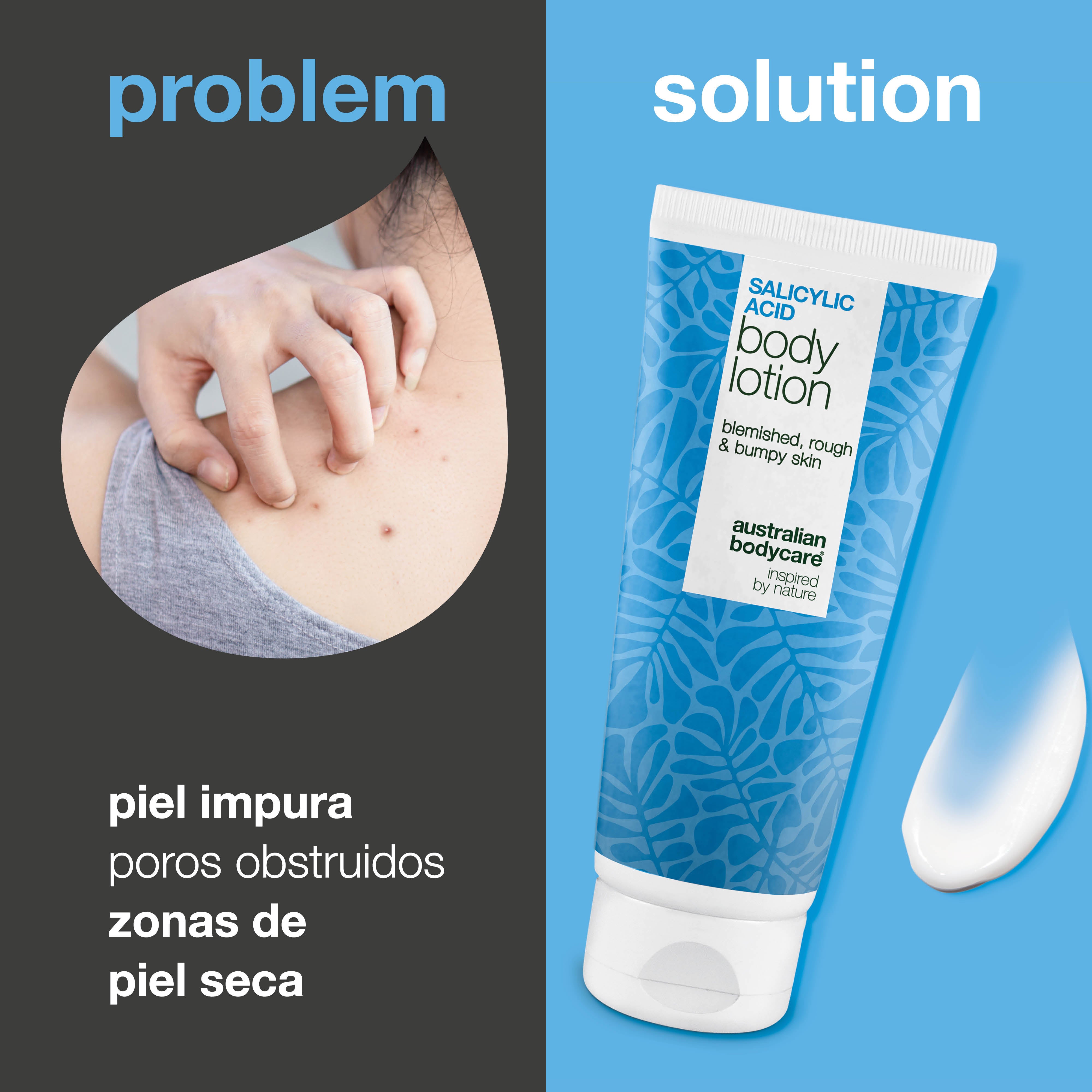 Loción corporal con ácido salicílico – piel seca y áspera — Loción corporal con ácido salicílico – piel seca y áspera