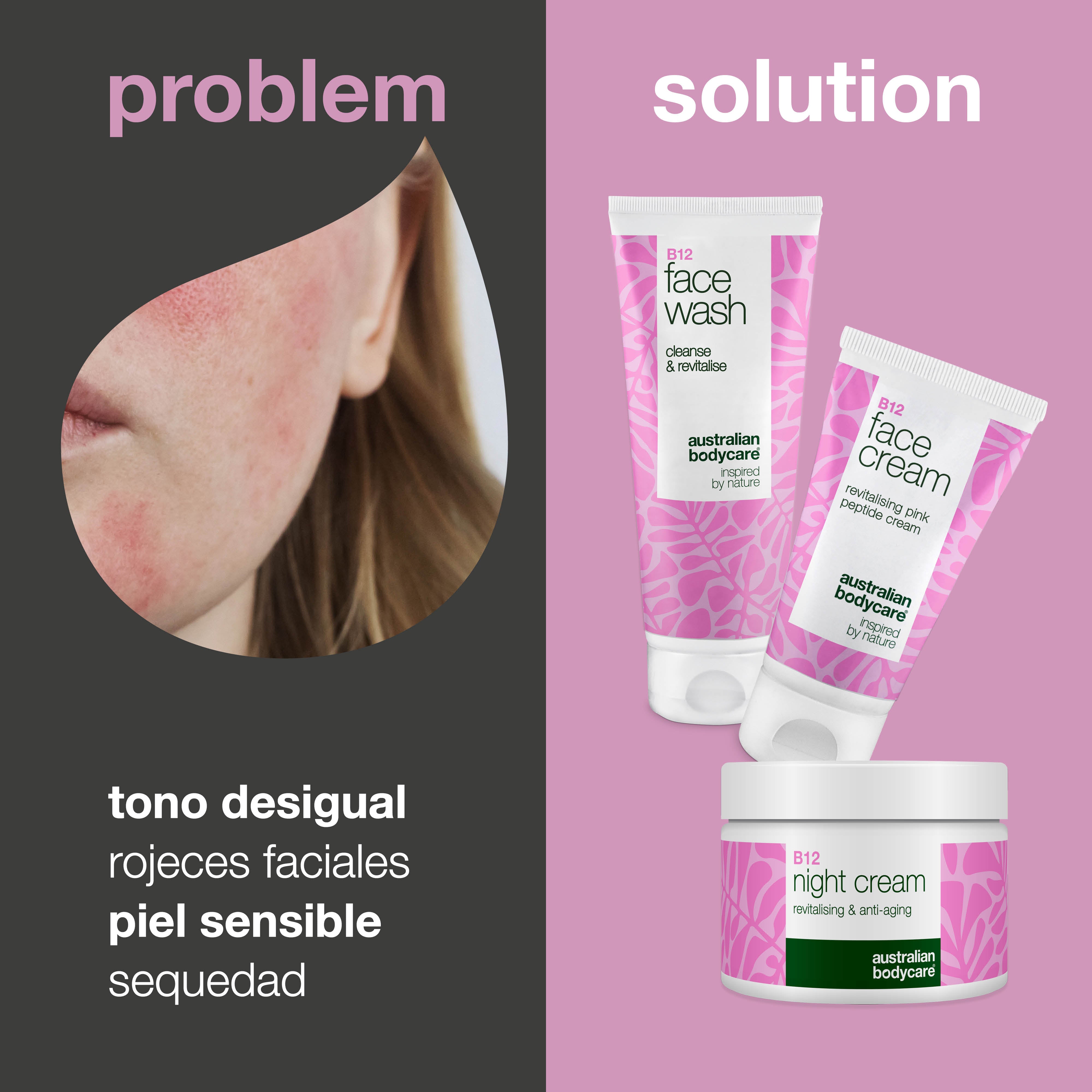 Set de cuidado de la piel B12 para enrojecimiento – Limpiador, crema de día y noche: cuidado de la piel B12 para pieles con enrojecimiento y tendencia a la rosácea. Limpiador, crema de día y crema de noche que calman e hidratan.