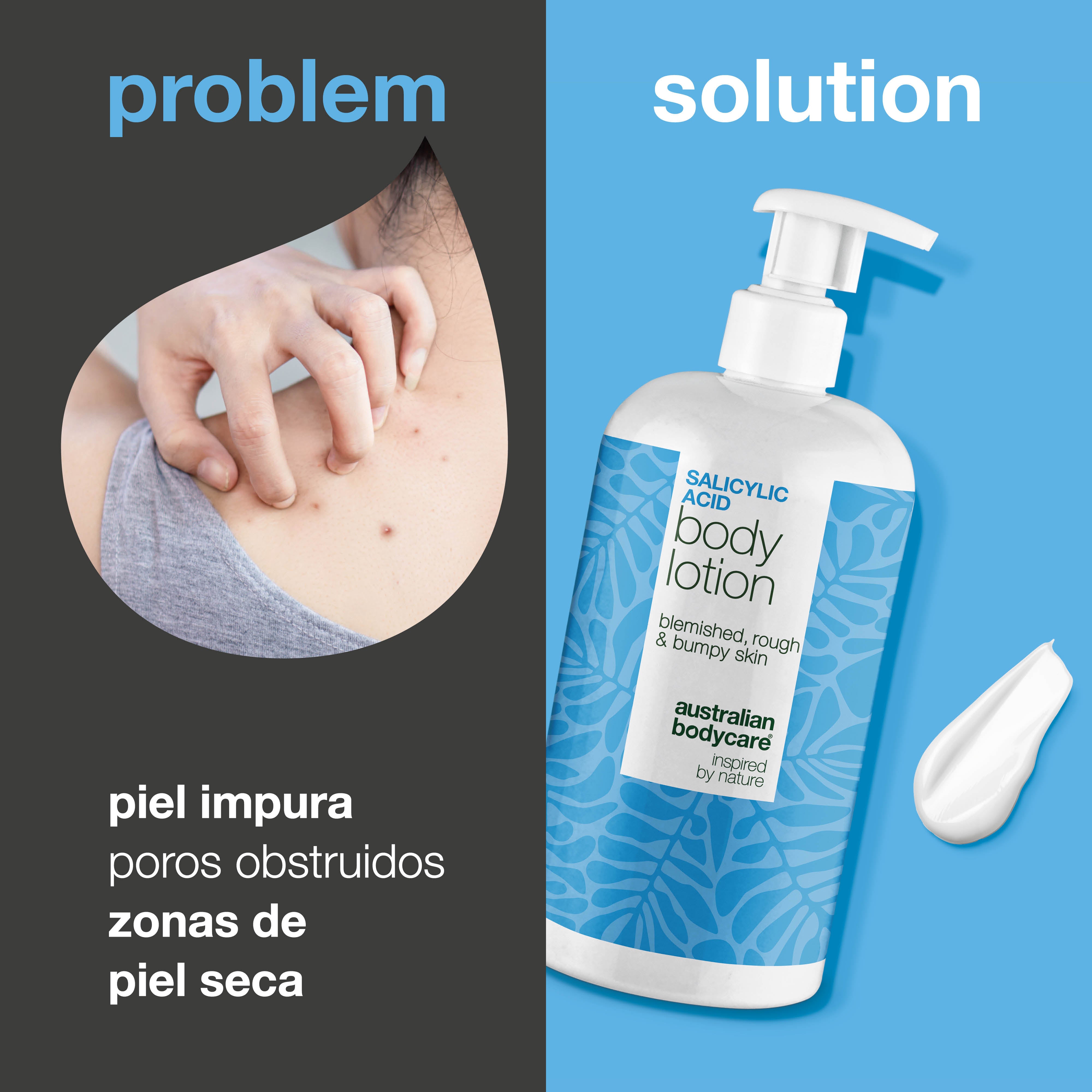 Loción corporal con ácido salicílico – piel seca y áspera — Loción corporal con ácido salicílico – piel seca y áspera