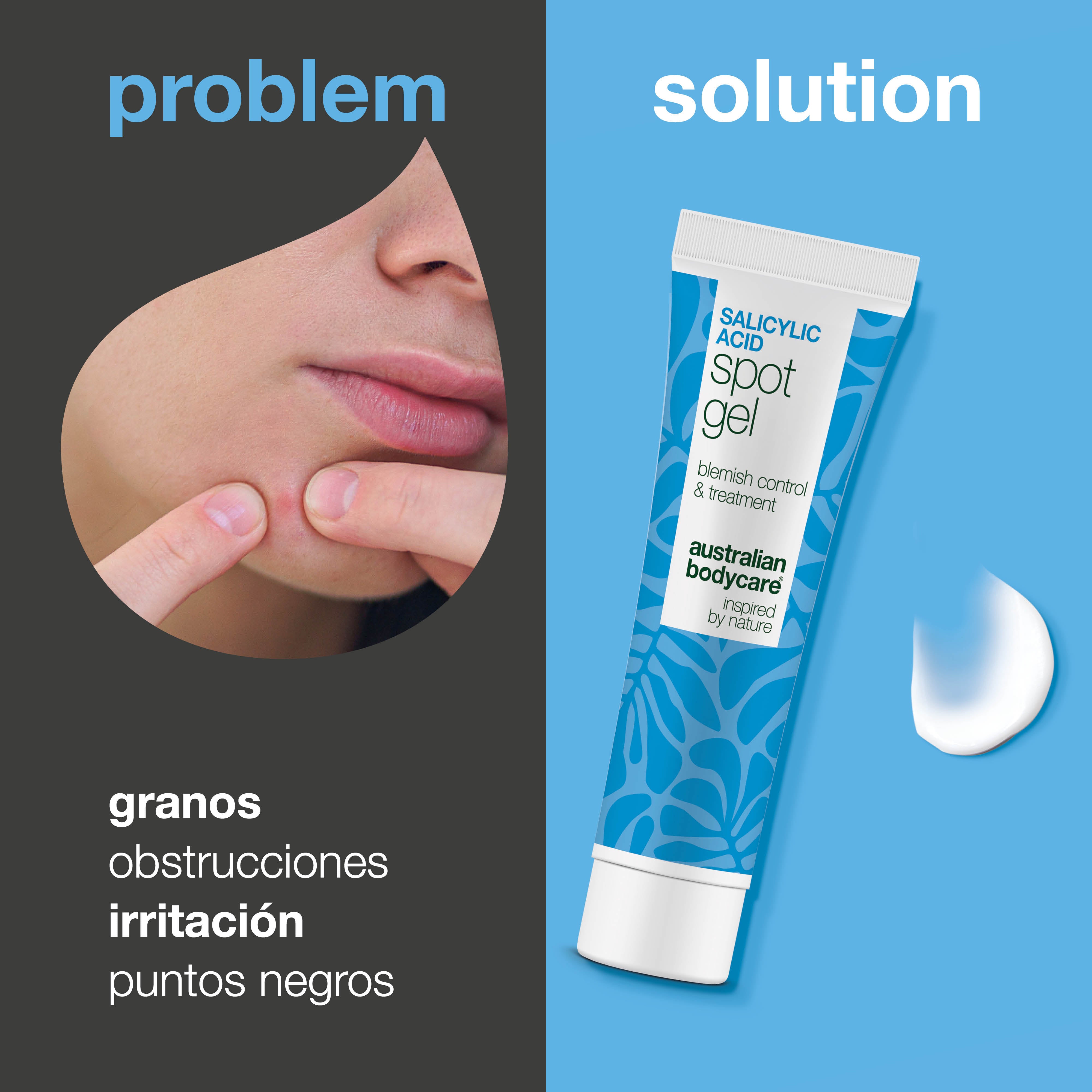 Gel puntual con ácido salicílico contra granos, puntos negros y rojeces – limpia y calma la piel