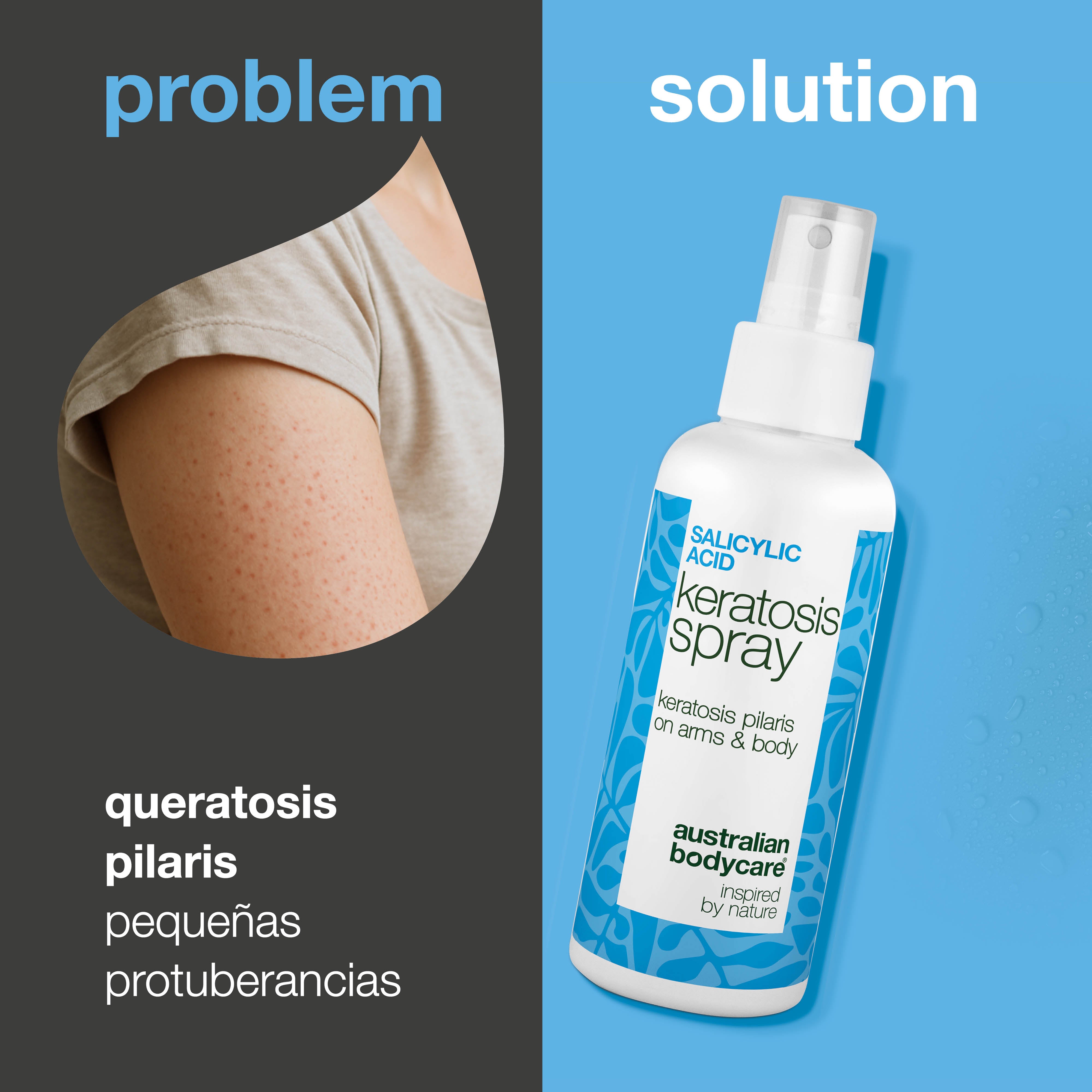 Spray queratosis pilaris para piel áspera y granitos — Keratosis pilaris spray suaviza piel áspera y granitos. Contiene ácido salicílico para exfoliar y limpiar los poros.