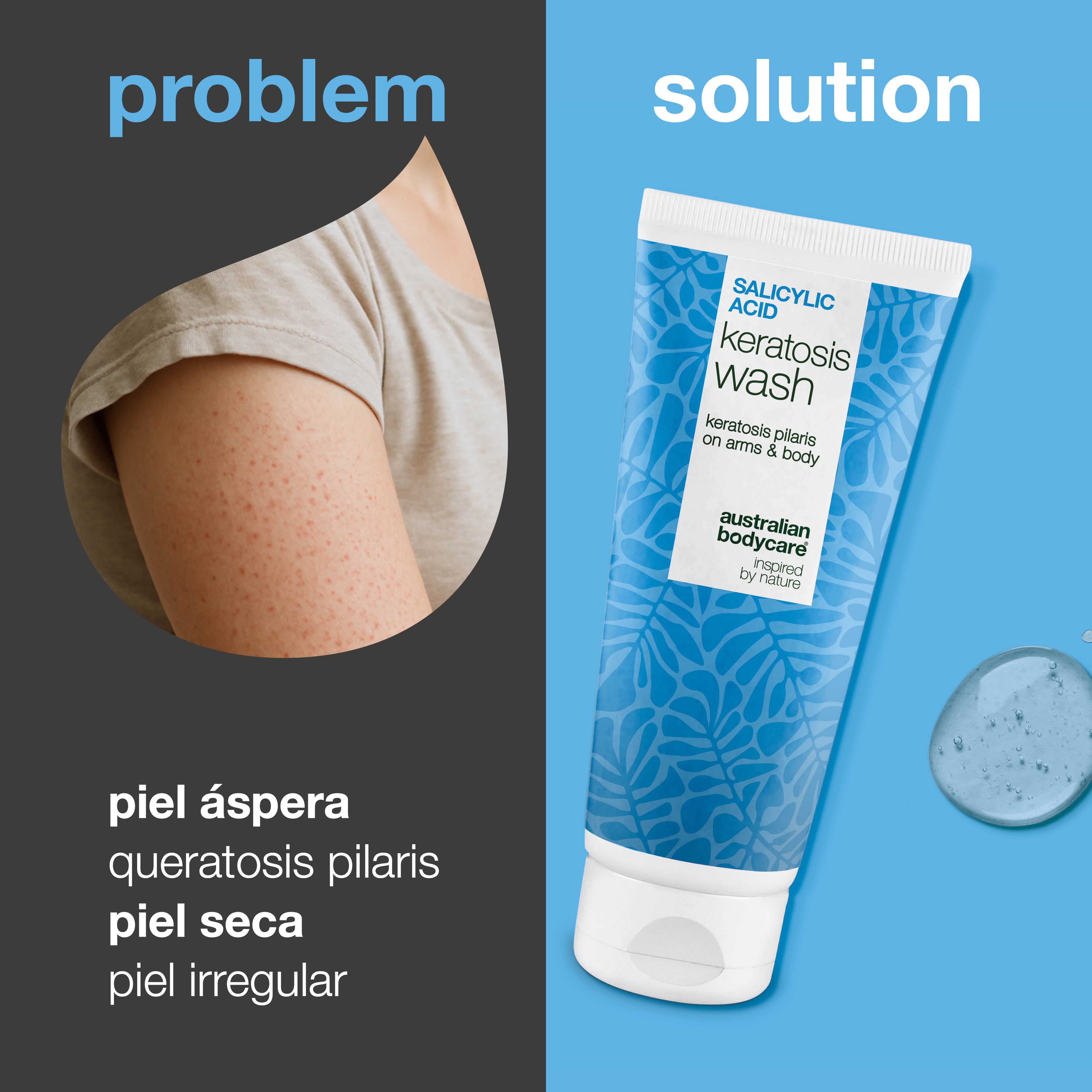 Keratosis Pilaris Body Wash contra la queratosis pilaris, poros obstruidos y rojeces. Con ácido salicílico, niacinamida, zinc PCA y vitamina E.
