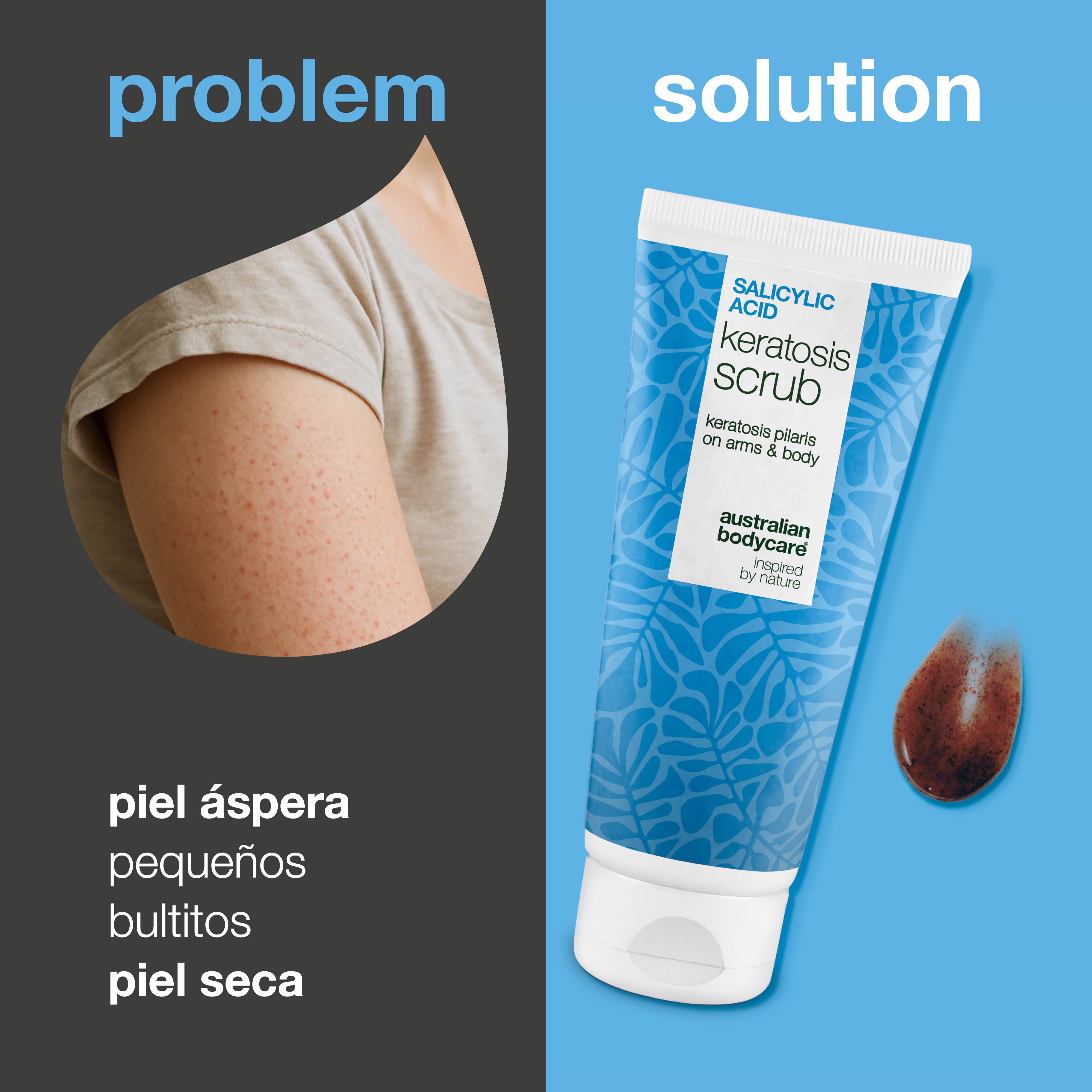 Exfoliante Corporal Queratosis Pilaris elimina células muertas y reduce bultitos. Suaviza con ácido salicílico, ácido glicólico, alantoína y glicerina.