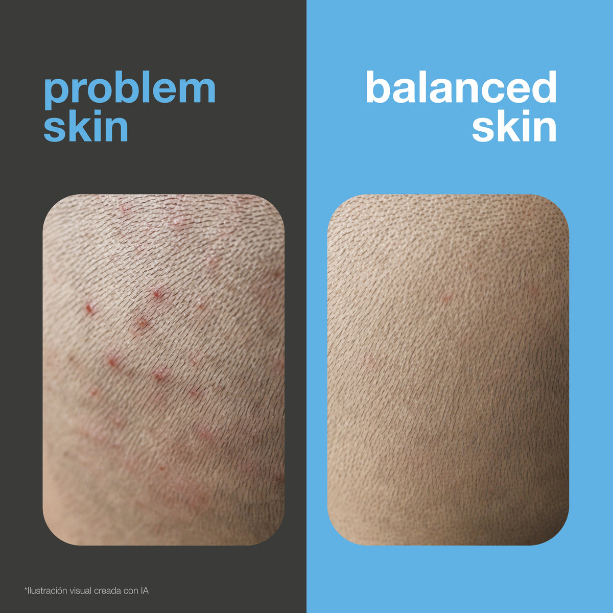 Antes y después: cuero cabelludo con granitos rojos e irritación frente a un cuero cabelludo calmado y equilibrado. Ilustración visual.