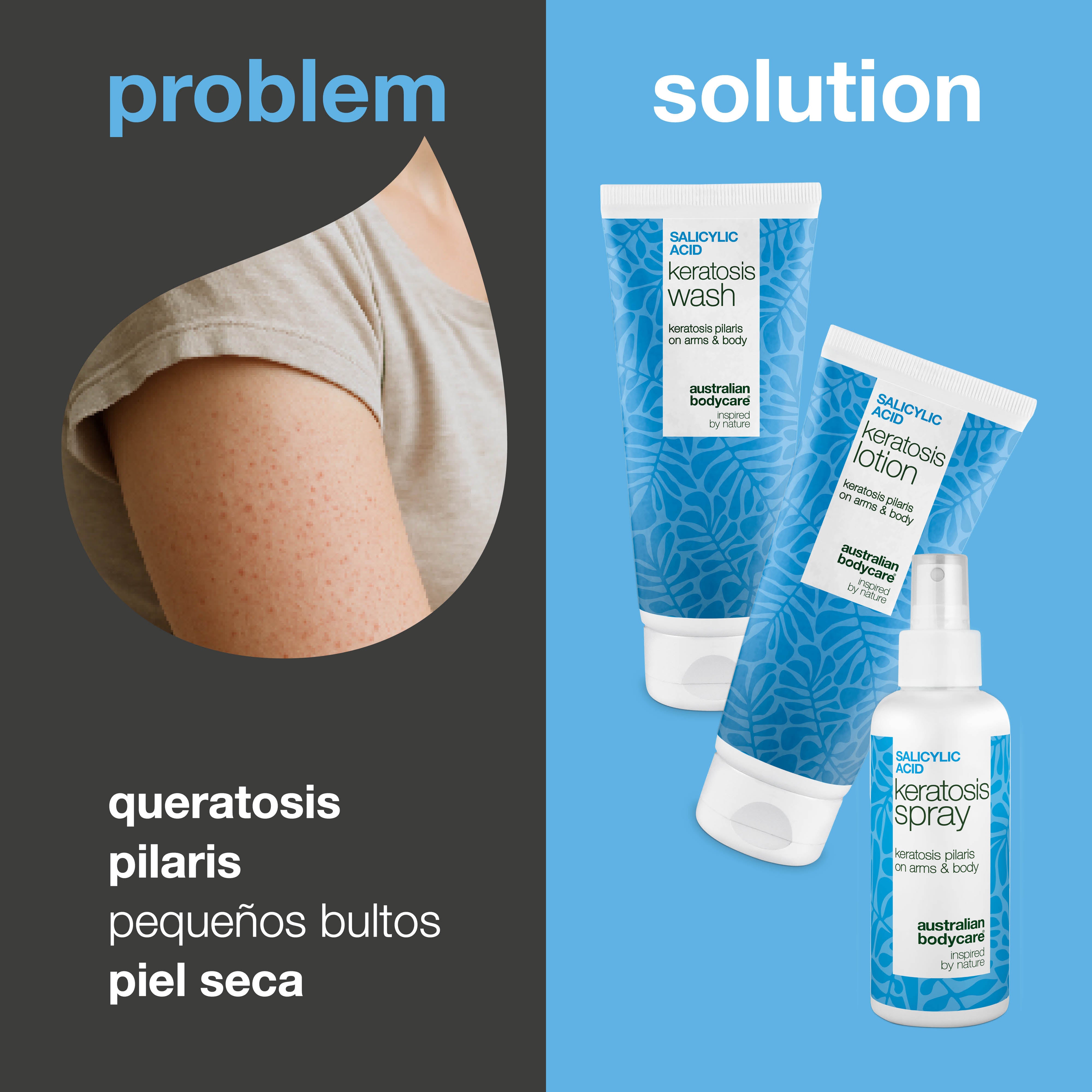 Pack Queratosis Pilaris – Suaviza piel seca y rugosa — Tratamiento corporal contra la Queratosis Pilaris reduce la piel rugosa y con textura irregular para una piel suave.