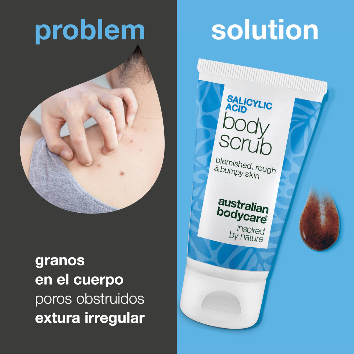 Problema y solución: granitos en el cuerpo, poros obstruidos y piel irregular. A la izquierda, primer plano de un hombro con granitos; a la derecha, el Salicylic Acid Body Scrub de Australian Bodycare