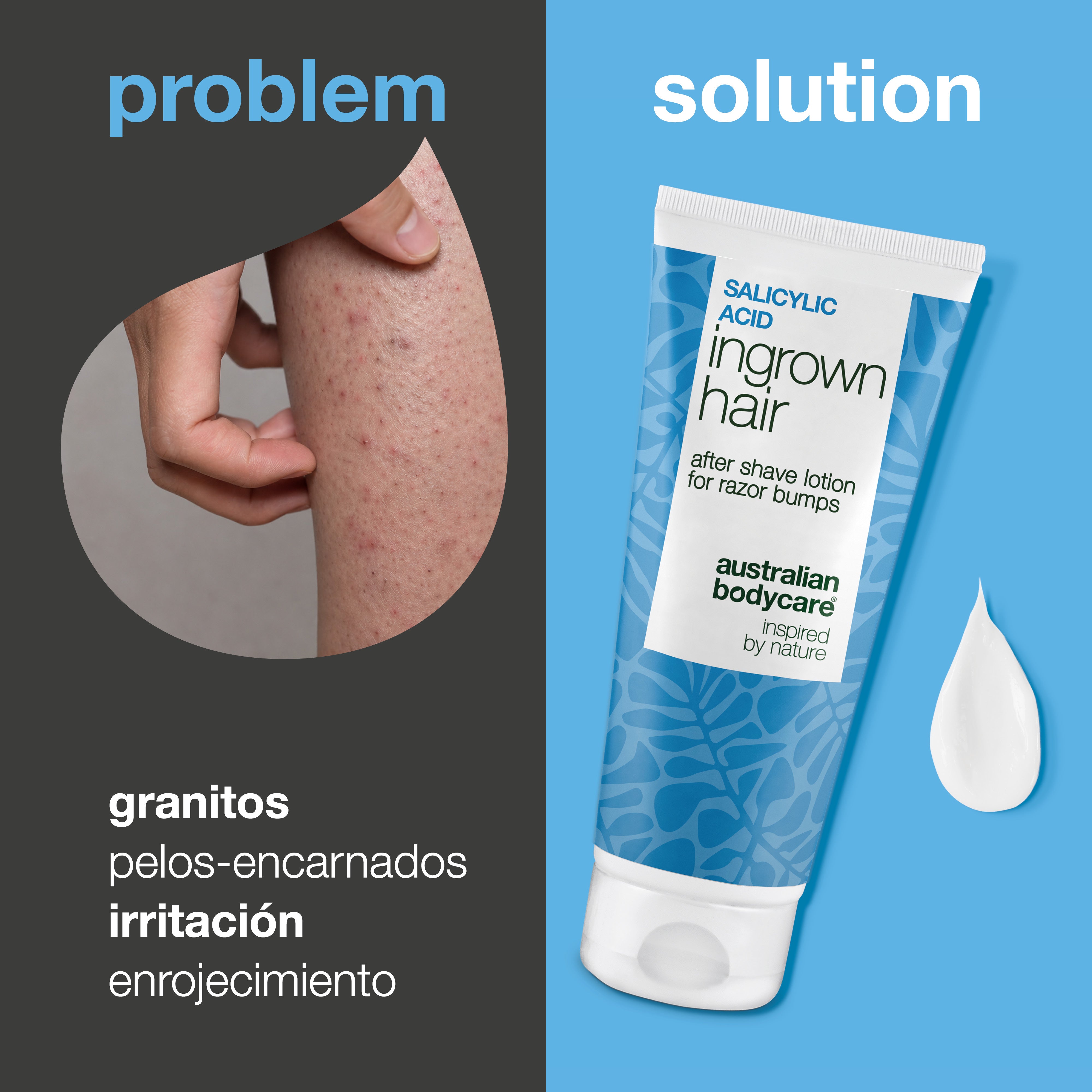 Loción After Shave con Ácido Salicílico para pelos encarnados, granitos rojos e irritación tras el afeitado. El producto aparece junto a una zona de piel con granitos rojos visibles y pelos encarnados.