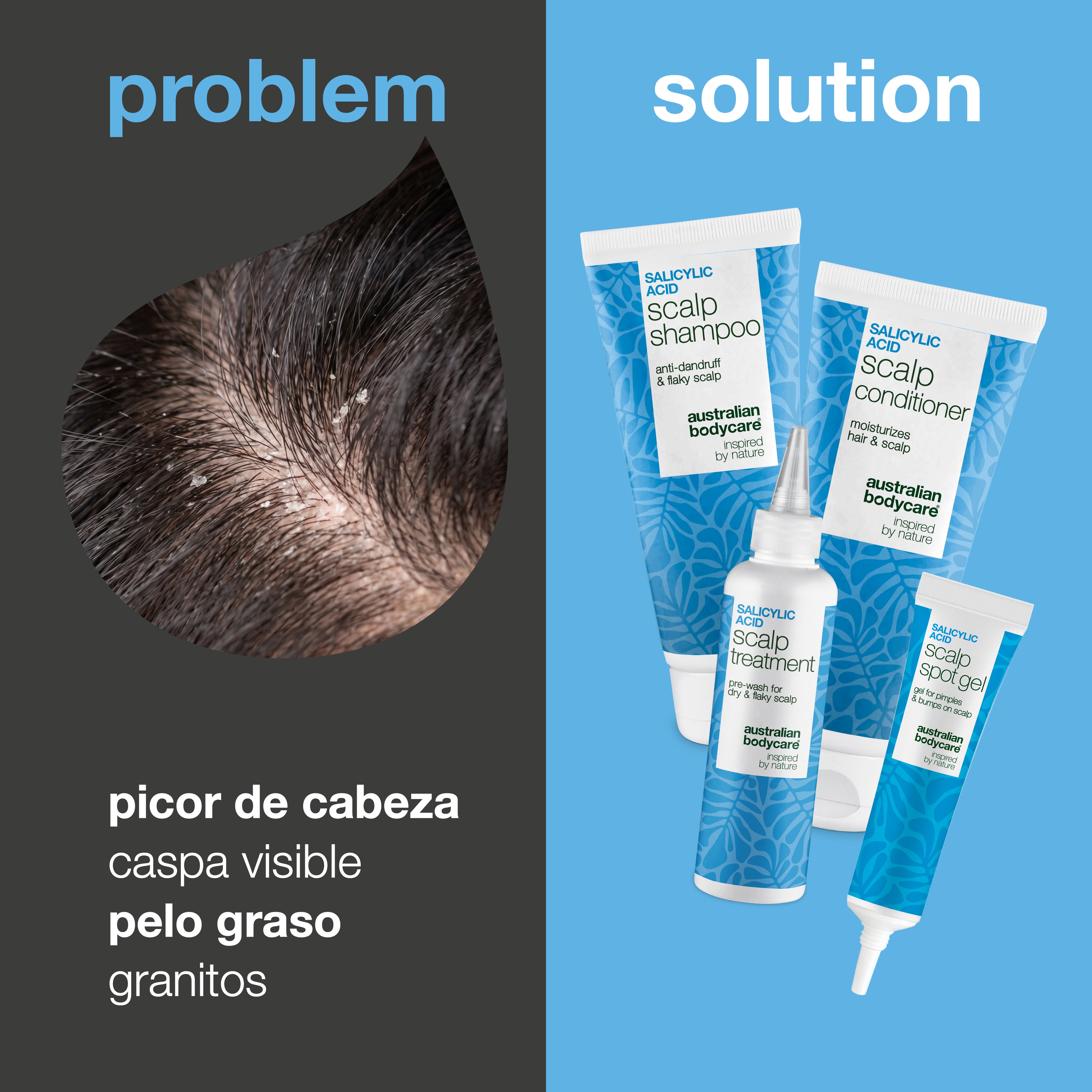 Problema y solución: primer plano de caspa en el cuero cabelludo junto a los cuatro productos contra picor, caspa y granos