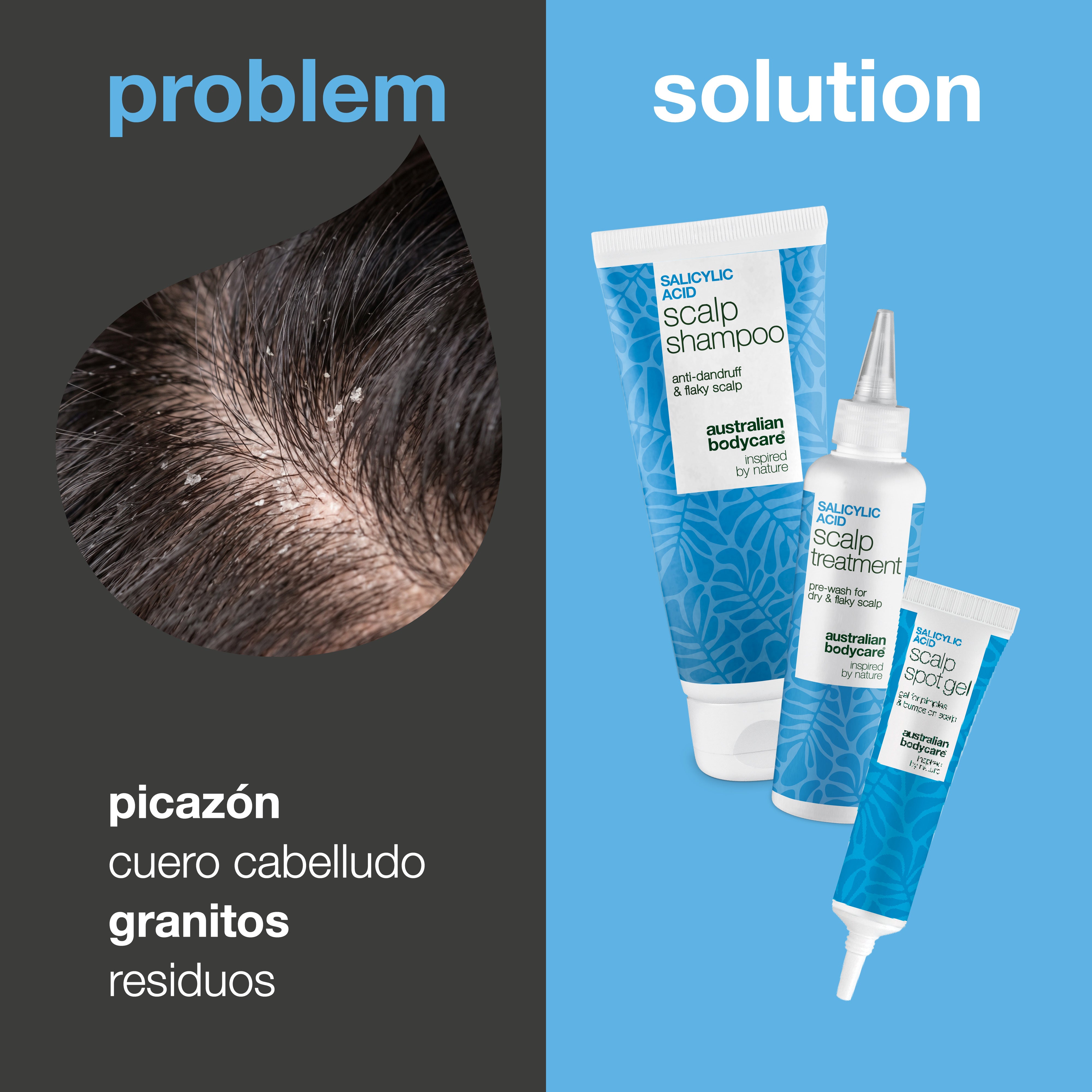 Problema y solución: primer plano de picor, pelo graso y acumulación en el cuero cabelludo junto a los tres productos del set