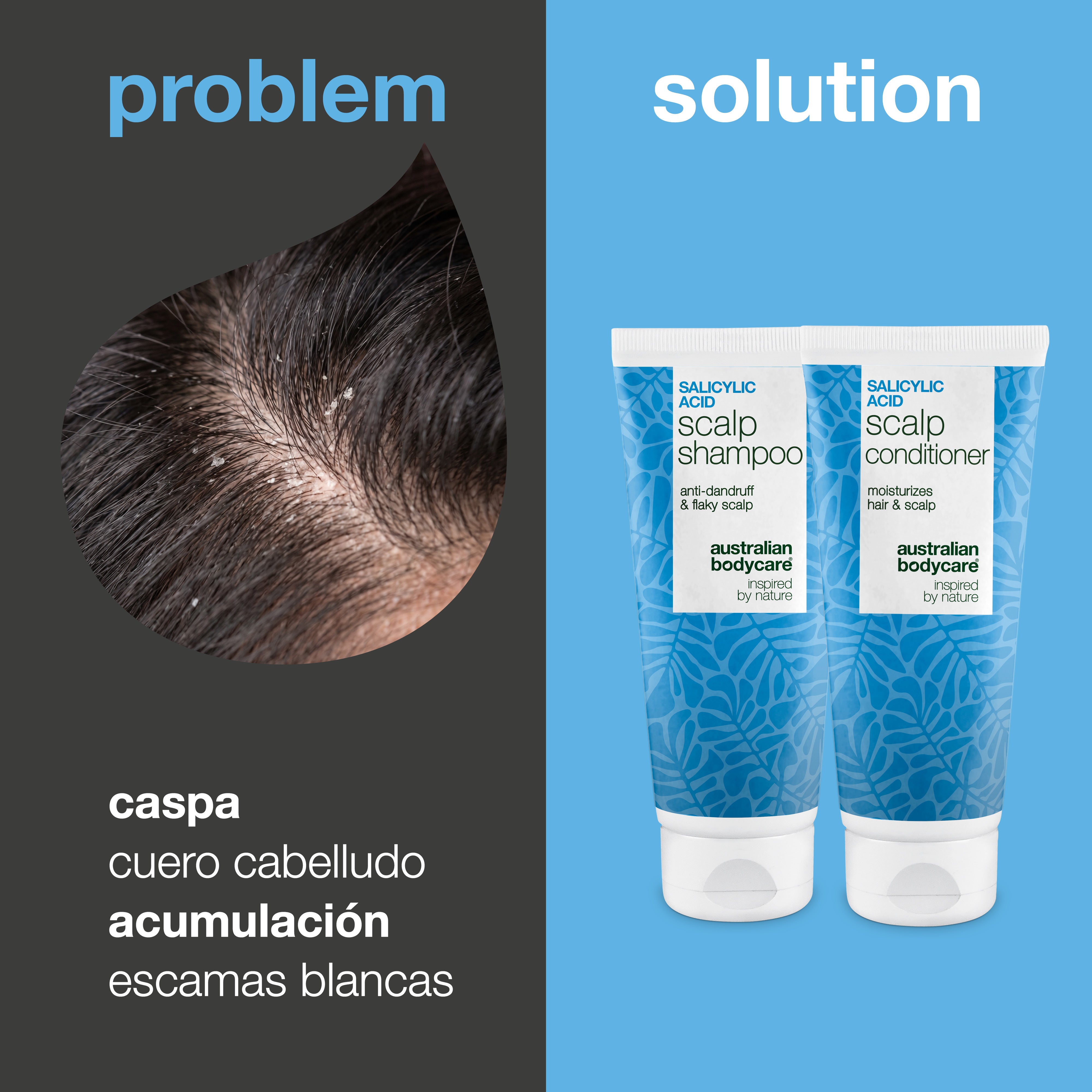 Problema y solución: primer plano de caspa y escamas blancas en el cuero cabelludo junto al champú y acondicionador del kit