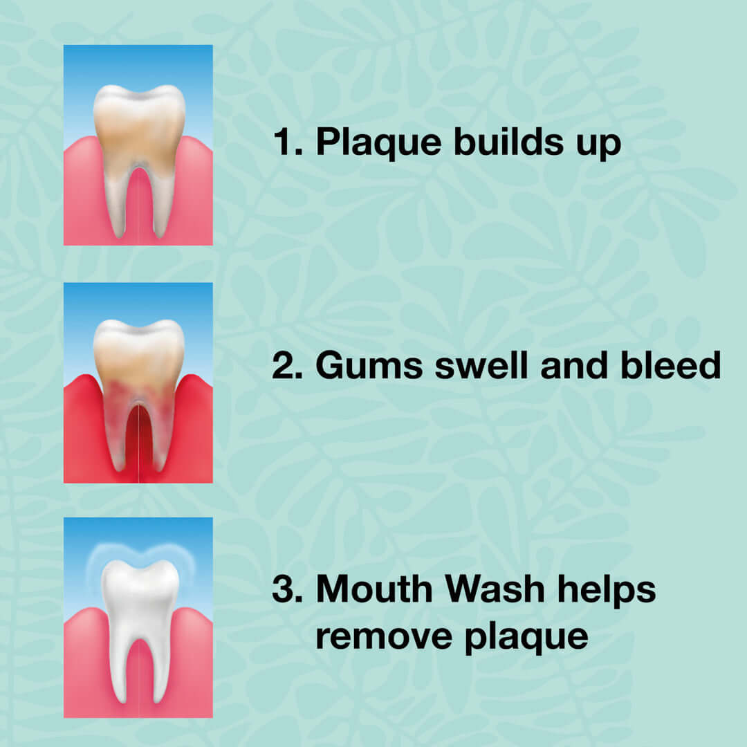 3 piezas de aceite de árbol de té pasta de dientes de menta fresca — Para el cuidado diario de la enfermedad periodontal, hongos y gingivitis