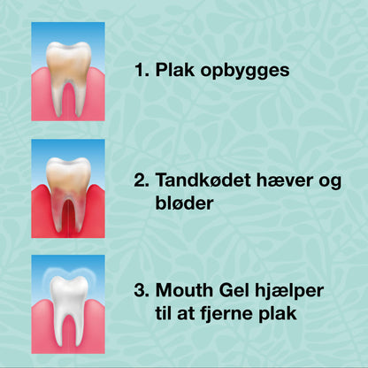 Kit de inicio – 5 productos bucales - Kit de inicio para una buena higiene bucal y cuidado de la enfermedad periodontal y hongos