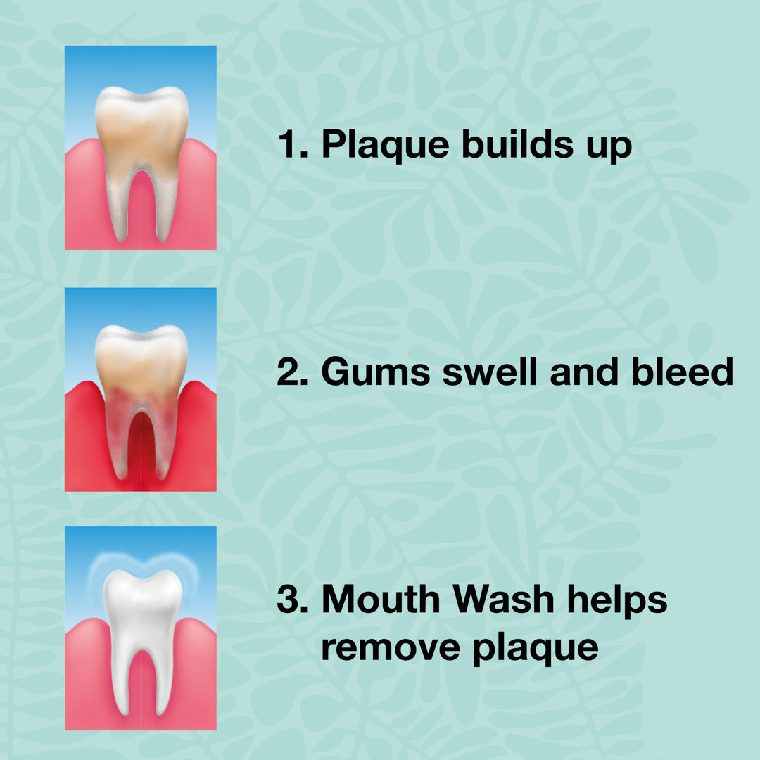 Pack Bucal de 4 productos con aceite de árbol de té — Para el cuidado diario de la candidiasis oral, periodintitis y gingivitis